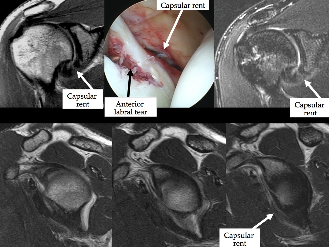 Figure 3 for case dislocation ( RID4770 )